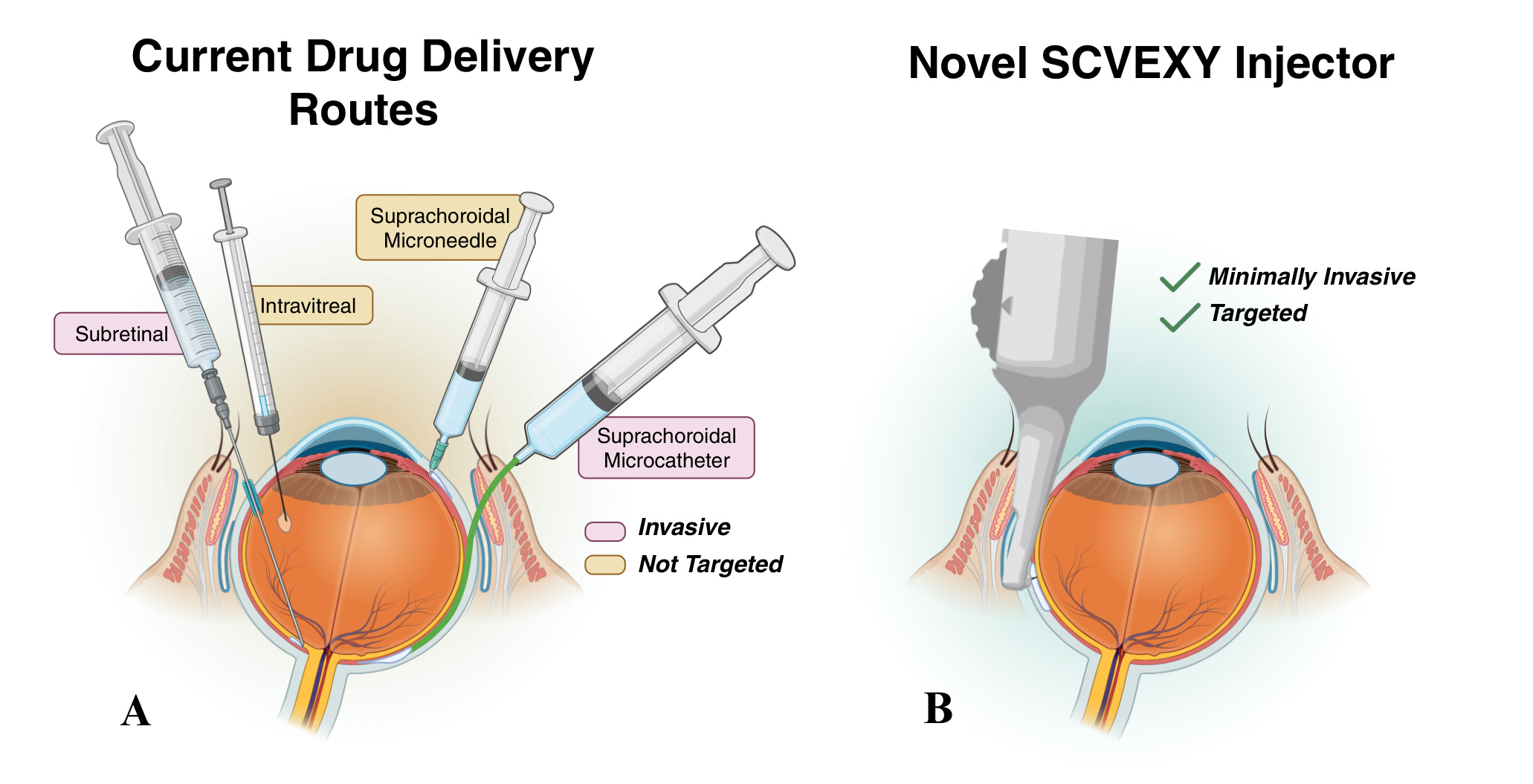 Current drug delivery routes vs novel SCVEXY injector