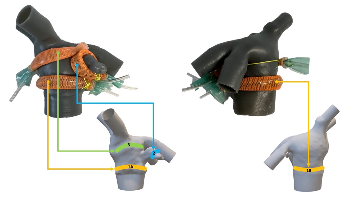 Soft robotic heart model with pneumatic actuators