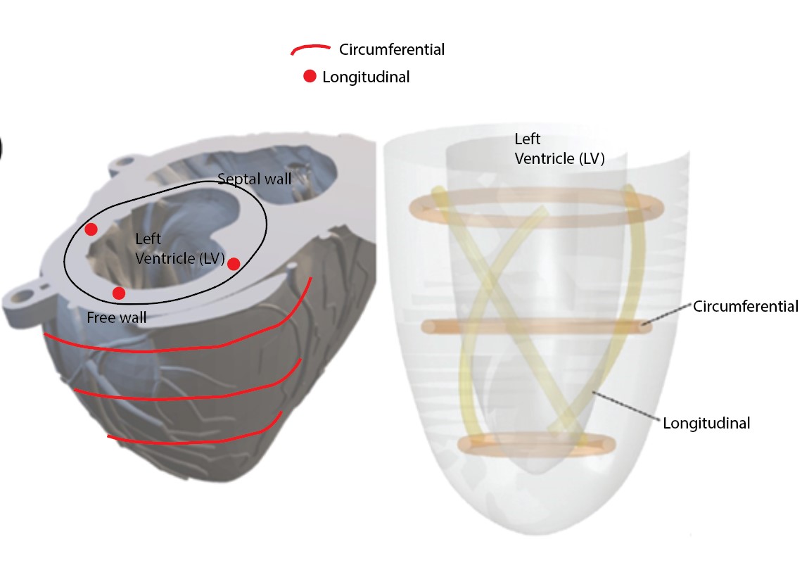 CAD model of heart ventricle showing actuator placement locations
