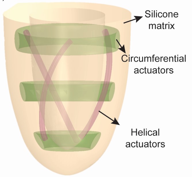 Diagram of left ventricle with circumferential and helical actuators in silicone matrix